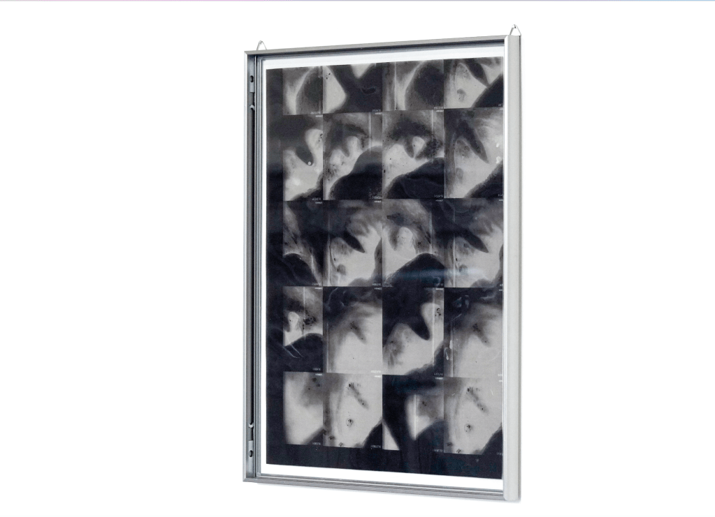 Installation view of fix it till you make it (2025), a mixed-media work by Flavia Spasari incorporating archival materials, medical imaging (ultrasound and X-ray), engraving, a laryngeal polyp forceps, and a walkman. Shown in the exhibition Overlapping Heads at Palazzetto Tito, Fondazione Bevilacqua La Masa, Venice. Courtesy of the artist